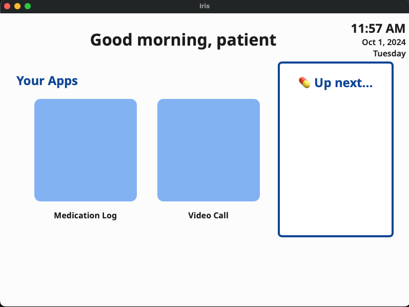 Iris User Interface